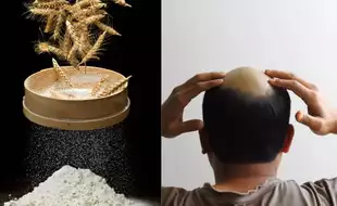 Toxic Wheat Caused Sudden Baldness in Maharashtra Village, Claims Study; Here's How