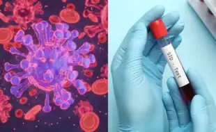 Breaking the Outbreak: Rethinking Skin-Related STIs and the Stigma Around Herpes and Warts
