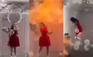 Birthday Party Horror: Woman Suffers Facial Burns As Hydrogen Balloons Explode – The Hidden Dangers You Need To Know!