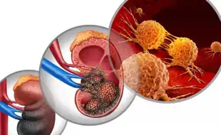 Groundbreaking New Vaccine Claims To Reverse Cancer In Those With the Fatal Disease; Here's How
