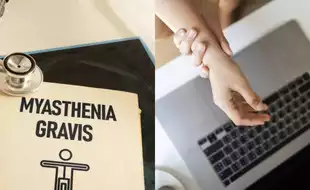 World Rare Diseases Day: What is Myasthenia Gravis, A Chronic Autoimmune Disorder That Causes Weakness in Facial Muscles?