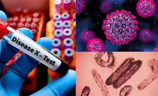 Disease X Fears: From Brain-Swelling Flu To Eye-Bleeding Fever, Scientists Warn 4 Viruses Could Trigger The Next Pandemic