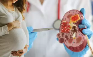 Pregnancy and Kidney Stones: A Rocky Road? Experts Weigh In on Risks and Remedies