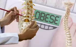 The Weighty Truth: How Obesity Undermines Your Spine and Bones