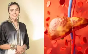 Hrithik Roshan’s Sister Sunaina Reveals Hacks On How She Reversed Grade 3 Fatty Liver With Simple Lifestyle Swaps