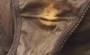 We Finally Have the Answer to Your Burning Question—Why Does Women's Underwear Get Those Ugly Bleach Stains?
