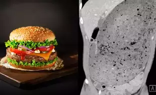 Man Ends Up With Horrific Consequences Of Speed Eating A 3kg Burger; Here's What Happens When You Binge Eat