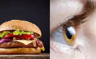 Young Boy Goes Blind After Eating Junk Food; Know How Restricting Nutrition Is Dangerous For Your Health