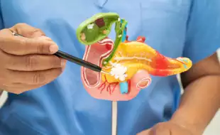 7 Early Warning Signs of Pancreatic Cancer You Shouldn't Ignore