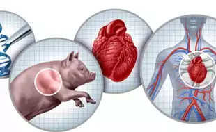“You’ve Got A Pig’s Heart!” Genetically Modified Pigs With Human-like Organs Transforming Organ Donation; Details Inside