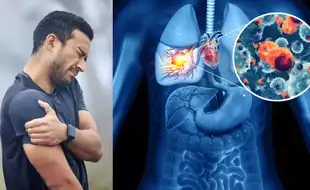 Silent Symptoms of Lung Cancer That Show Up On Your Shoulders, Neck