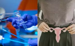 Fact Check: Viral Video Alleges Pap Smears Damage The Cervix—Here's What Experts Say