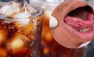 THIS Drink Is More Toxic Than Poison and can Increase Risk of Oral Cancer by 5x