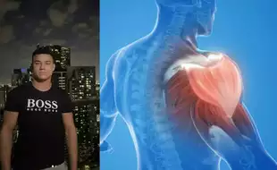 A Young MMA Fighter Dies Due to A Rare Condition Triggered by Intense Gym Training; What Is Rhabdomyolysis?