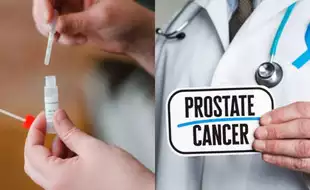 THIS Simple At-Home Test Can Help Diagnose Prostate Cancer, Is More Accurate Than a Blood Test
