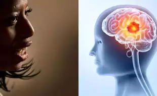 What Is Glioblastoma, the Aggressive Brain Cancer That Killed Former US Rep. Mia Love?