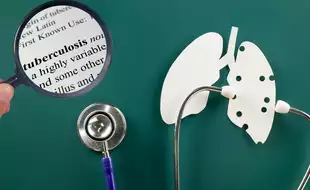 Post-Treatment TB Relapse: Why It Happens and How to Stop It for Good
