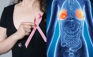 Breast Self-Exam: Your First Line of Defense in Catching Cancer Early;  Experts Weigh In