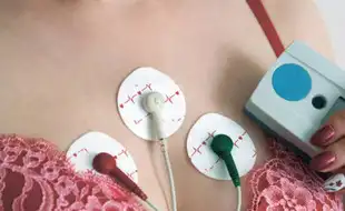 Woman With Complex Congenital Heart Disease Receives World’s First Leadless Pacemaker Implant; Know How It Helps