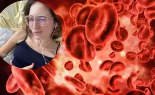 Woman Who Thought Had Anxiety, Diagnosed With Blood Cancer With the Help of Chat GPT; Symptoms of Hodgkin’s Lymphoma