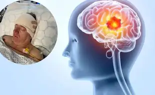 Man Who Missed Turns While Driving, Misplaced Things Diagnosed With Brain Tumour; Is Forgetfulness A Sign?