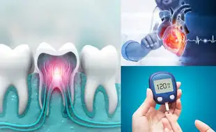 Poor Dental Conditions Can Worsen Existing Chronic Diseases, Says Top Dentist Lt. Gen Vimal Arora (Retd.)