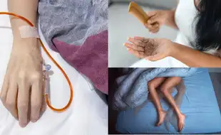 Unusual Signs Your Body is Struggling with Low Iron Levels