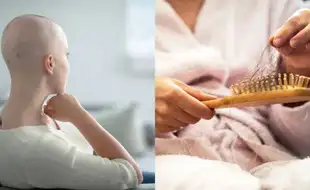 How Long Does It Take For Hair To Grow Back After Cancer Treatment? Here's What Surgeon Says