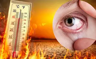 Heatwaves Can Cause Eye Stroke and permanent Blindness; Here's How To Take Care of Eyes In Sweltering Summer