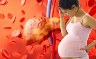 Acute Fatty Liver of Pregnancy: A Rare but Serious Condition Every Mom-to-Be Should Know